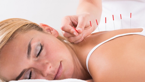 Does Acupuncture Relieve Pain?